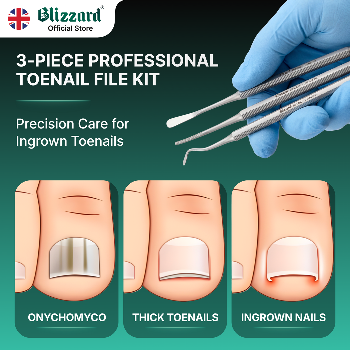 3-piece professional toenail file kit with tools and illustrations of nail conditions on a green background.