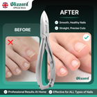 Blizzard® Professional Toenail Clippers for Thick Nails – 14.5cm, Straight Head, Smooth Handles