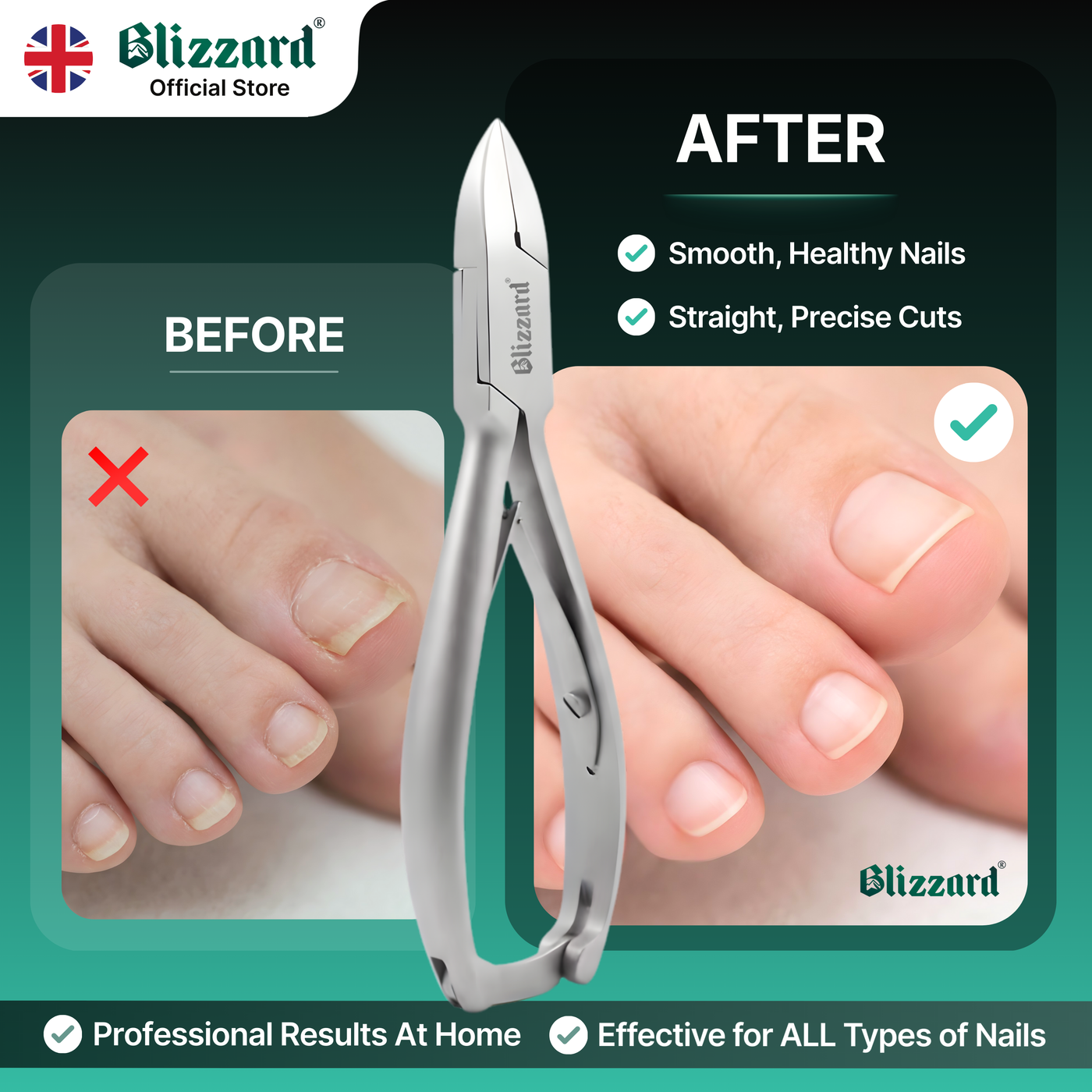 Blizzard® Professional Toenail Clippers for Thick Nails – 14.5cm, Straight Head, Smooth Handles