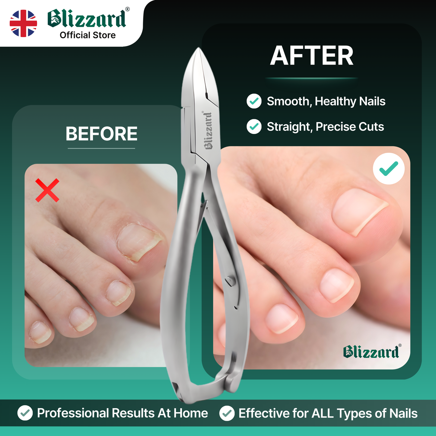 Blizzard® Professional Toenail Clippers for Thick Nails – 14.5cm, Straight Head, Smooth Handles