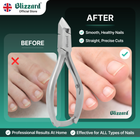 Nail clipper with 'Before' and 'After' comparison of nails on a green background, featuring the Blizzard brand.