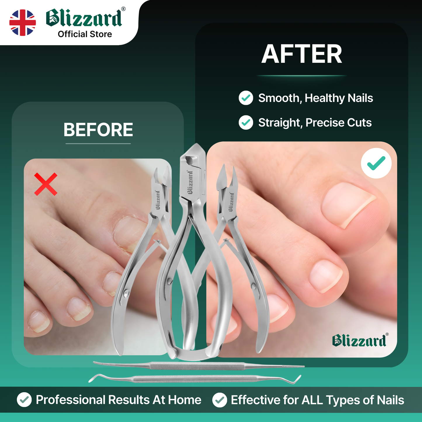 Blizzard nail clippers with 'Before' and 'After' comparison on a green background