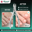 Nail clippers with 'Blizzard' branding, showing before and after effects on nails.