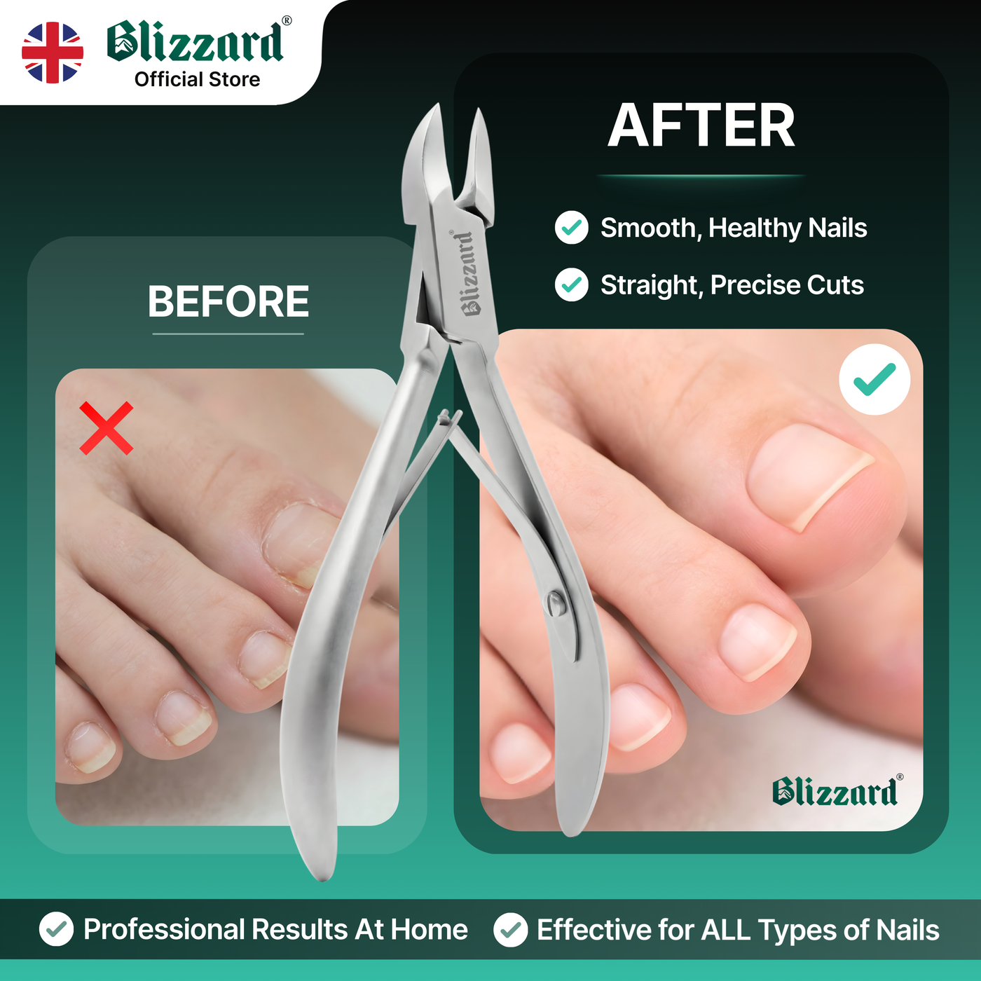 Nail clippers with 'Blizzard' branding, showing before and after effects on nails.
