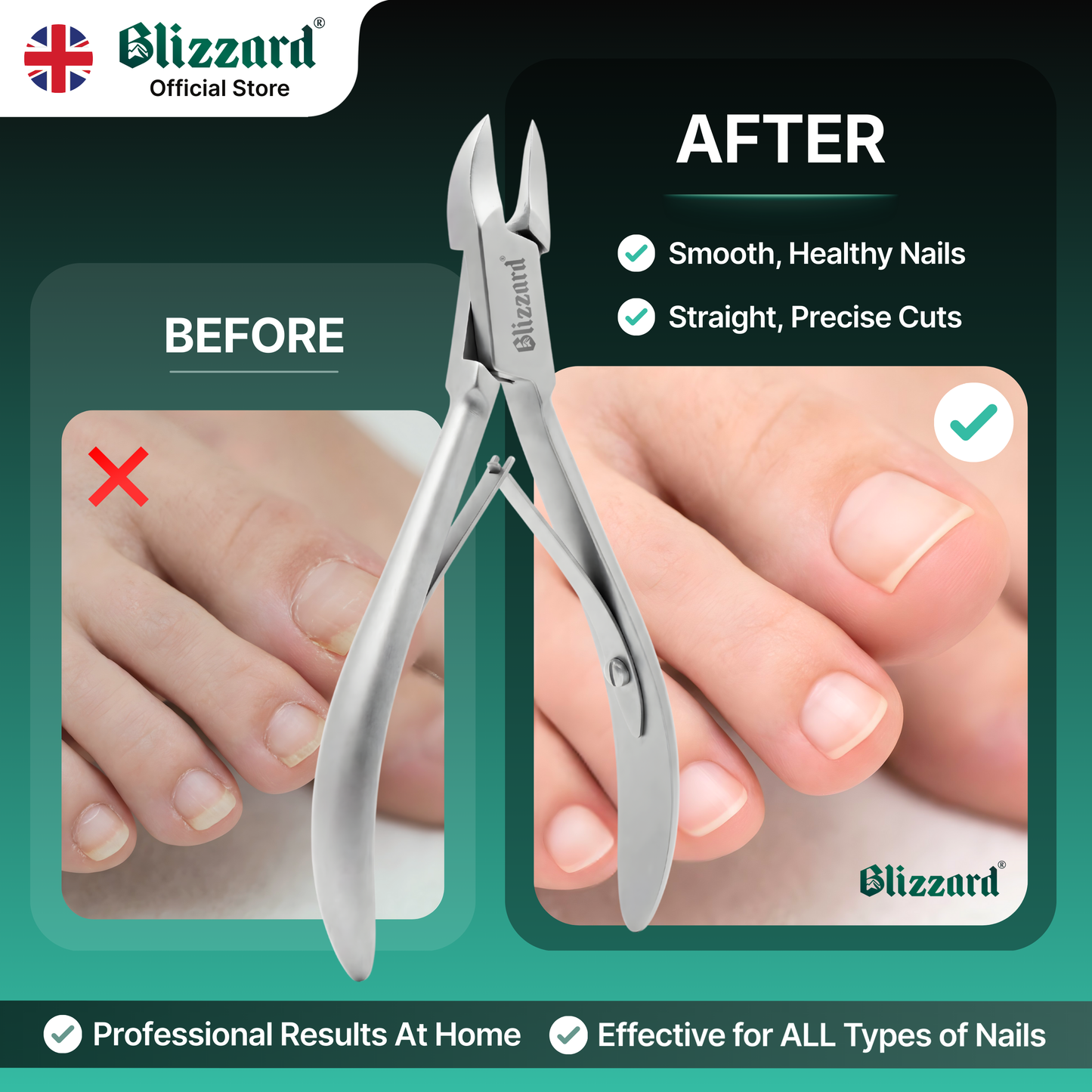 Nail clippers with 'Blizzard' branding, showing before and after effects on nails.