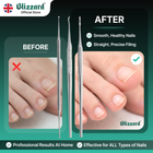 Before and after comparison of nail care tools with Blizzard branding.