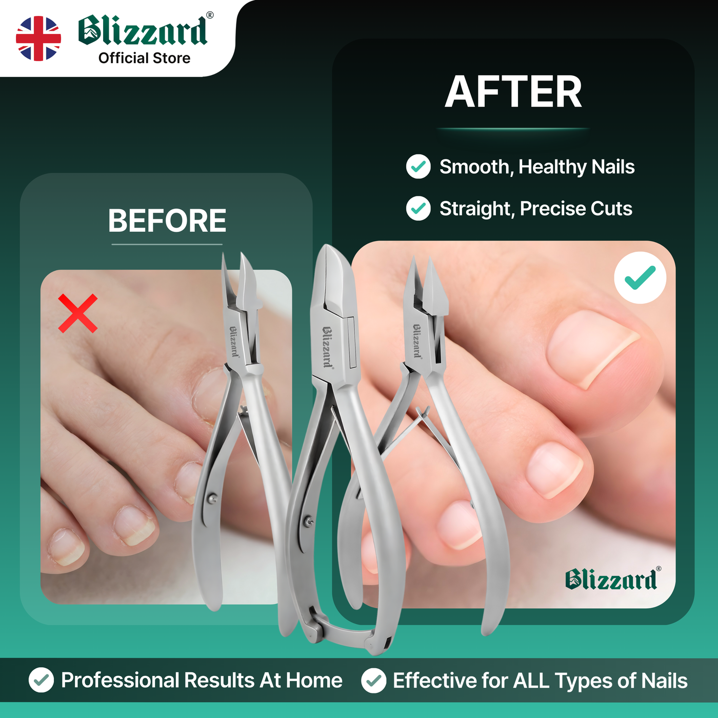 Blizzard® 3-Pcs Podiatry Nail Clippers Set | Concave, Arrow & Flame Heads