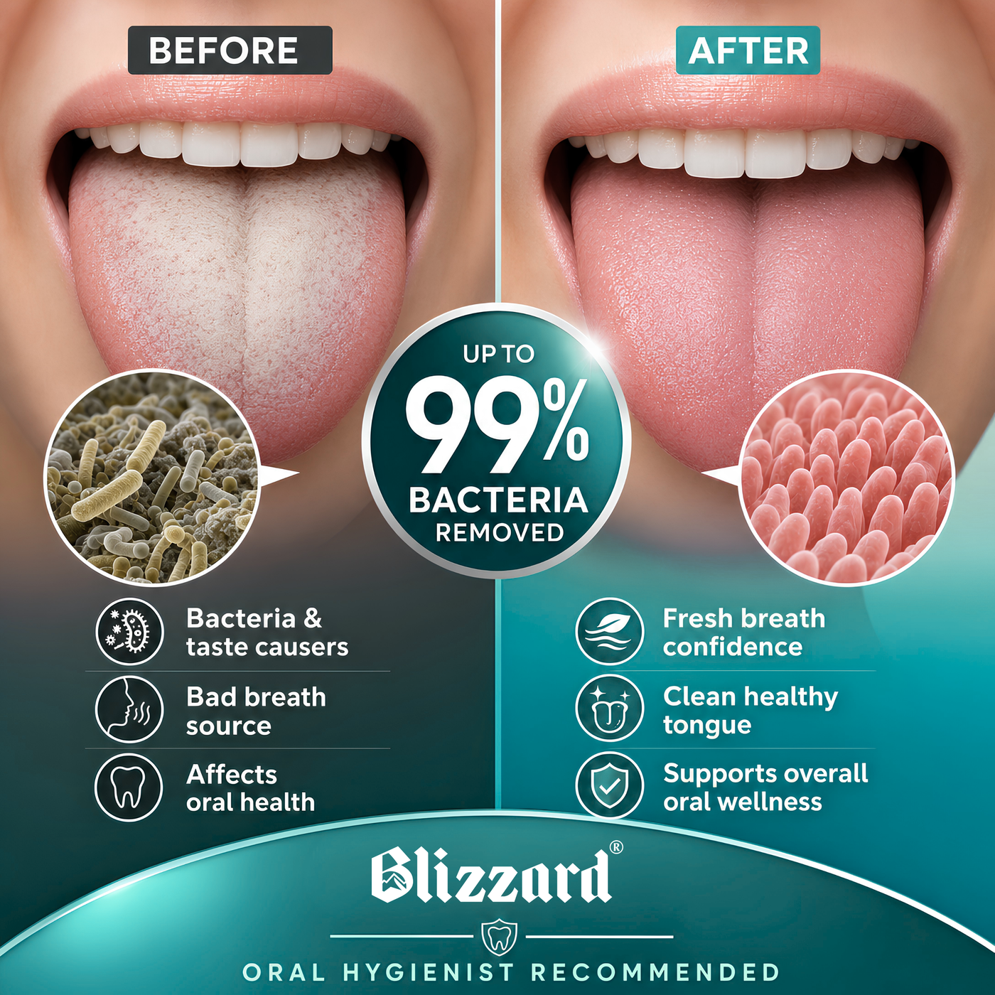 Blizzard 6-Pcs Dental Hygiene Kit | Stainless Steel Oral Care Set