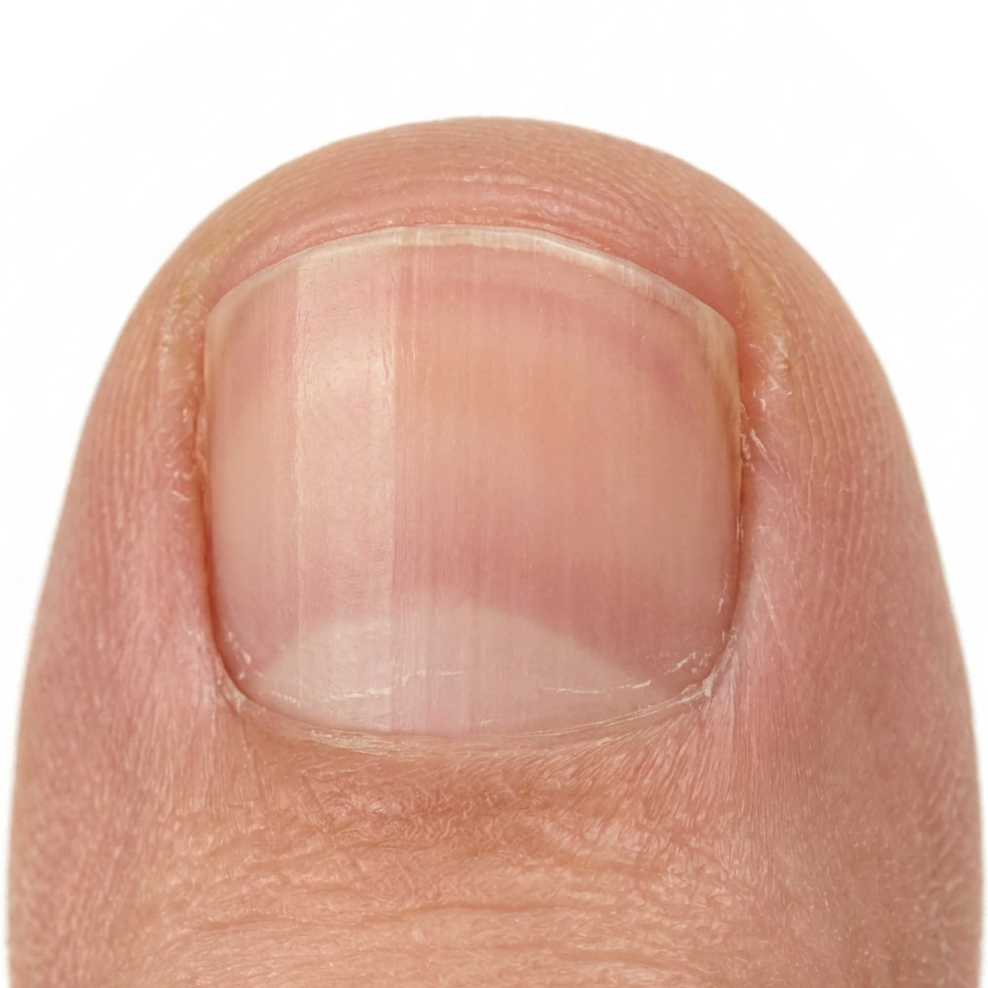 After image